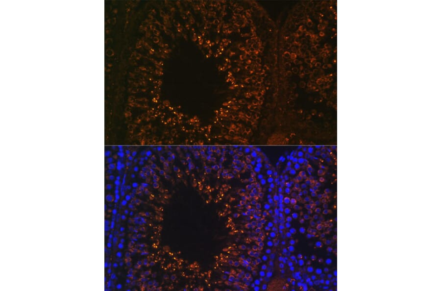 Immunofluorescence - Anti-LDHAL6B Antibody (A89828) - Antibodies.com