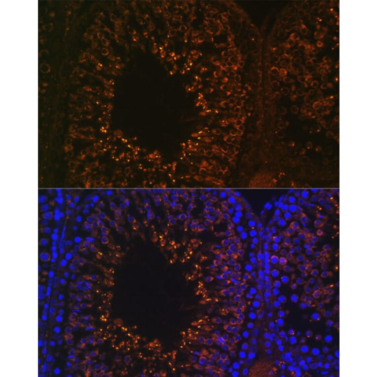 Immunofluorescence - Anti-LDHAL6B Antibody (A89828) - Antibodies.com
