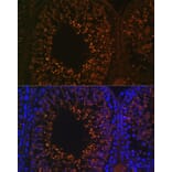 Immunofluorescence - Anti-LDHAL6B Antibody (A89828) - Antibodies.com