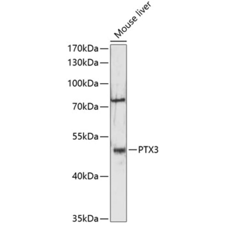 Western Blot - Anti-Pentraxin 3/PTX3 Antibody (A89829) - Antibodies.com