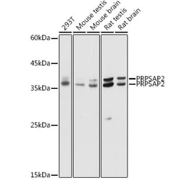 Western Blot - Anti-PRPSAP2 Antibody (A89830) - Antibodies.com