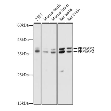 Western Blot - Anti-PRPSAP2 Antibody (A89830) - Antibodies.com