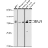 Western Blot - Anti-PRPSAP2 Antibody (A89830) - Antibodies.com