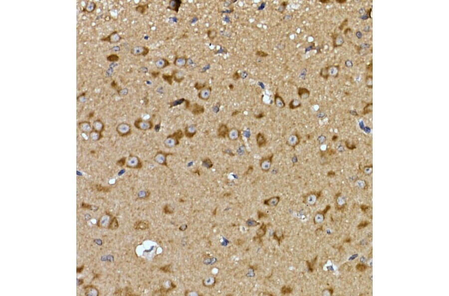 Immunohistochemistry - Anti-PRPSAP2 Antibody (A89830) - Antibodies.com