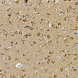 Immunohistochemistry - Anti-PRPSAP2 Antibody (A89830) - Antibodies.com