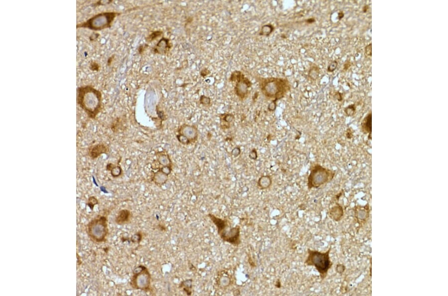 Immunohistochemistry - Anti-PRPSAP2 Antibody (A89830) - Antibodies.com