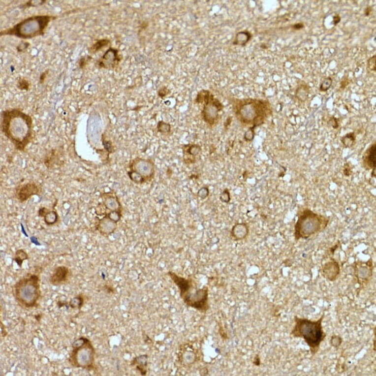 Immunohistochemistry - Anti-PRPSAP2 Antibody (A89830) - Antibodies.com