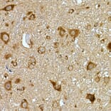 Immunohistochemistry - Anti-PRPSAP2 Antibody (A89830) - Antibodies.com