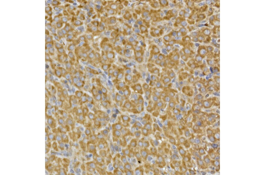 Immunohistochemistry - Anti-PRPSAP2 Antibody (A89830) - Antibodies.com