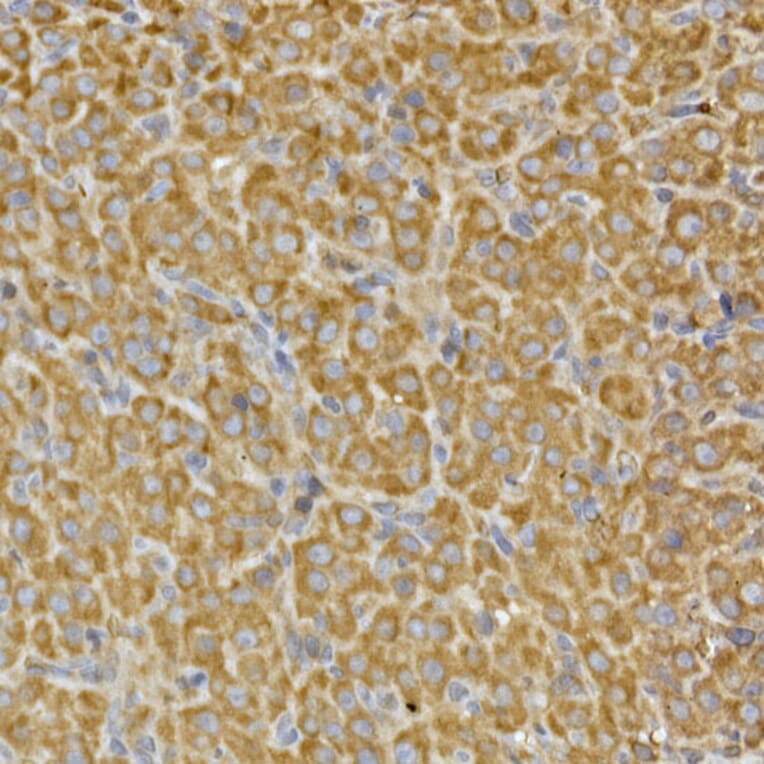Immunohistochemistry - Anti-PRPSAP2 Antibody (A89830) - Antibodies.com