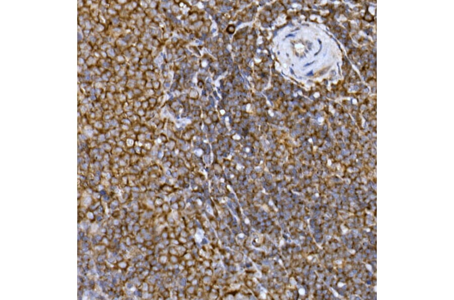 Immunohistochemistry - Anti-PRPSAP2 Antibody (A89830) - Antibodies.com