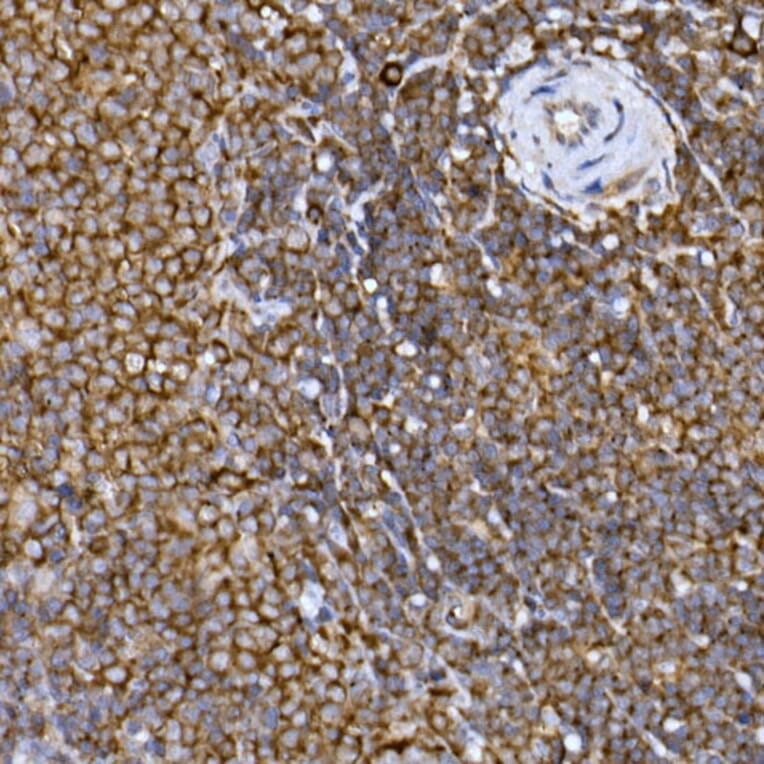 Immunohistochemistry - Anti-PRPSAP2 Antibody (A89830) - Antibodies.com