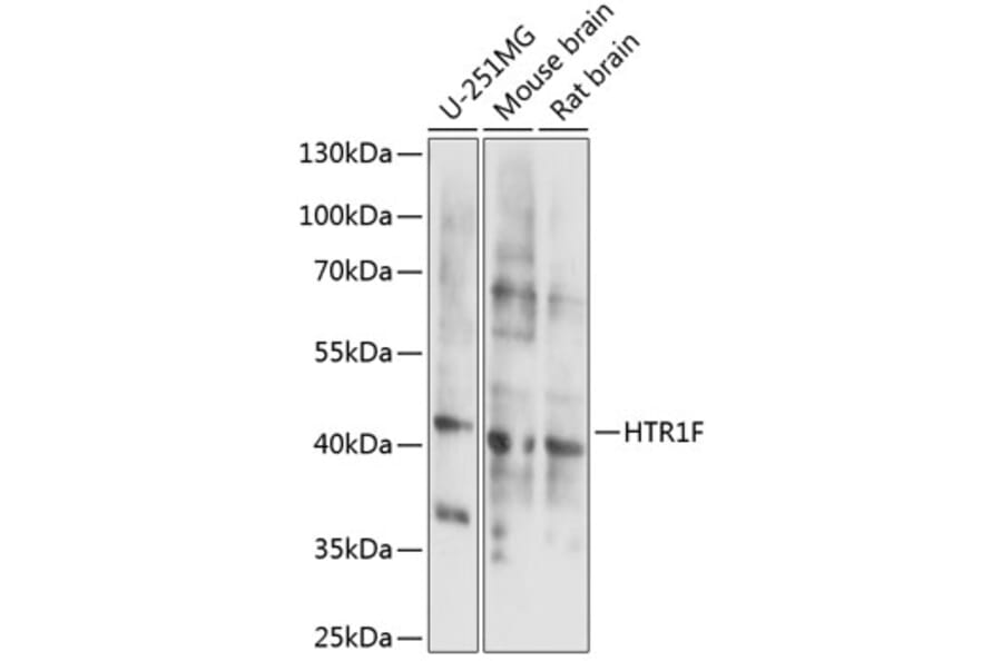 Western Blot - Anti-5HT1F Receptor Antibody (A89833) - Antibodies.com