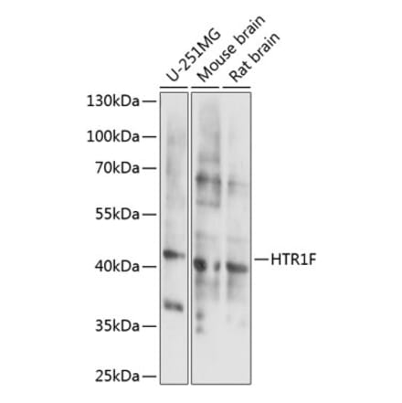 Western Blot - Anti-5HT1F Receptor Antibody (A89833) - Antibodies.com