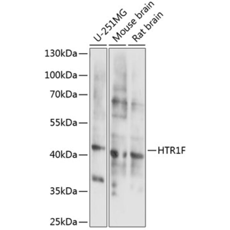 Western Blot - Anti-5HT1F Receptor Antibody (A89833) - Antibodies.com