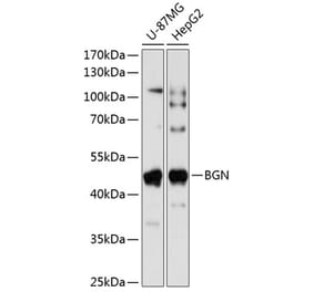 Western Blot - Anti-Biglycan Antibody (A89834) - Antibodies.com