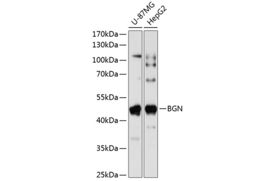 Western Blot - Anti-Biglycan Antibody (A89834) - Antibodies.com