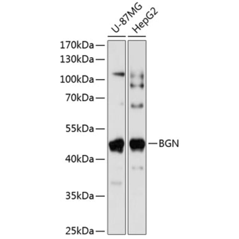 Western Blot - Anti-Biglycan Antibody (A89834) - Antibodies.com