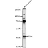 Western Blot - Anti-Cyt 19 Antibody (A89835) - Antibodies.com