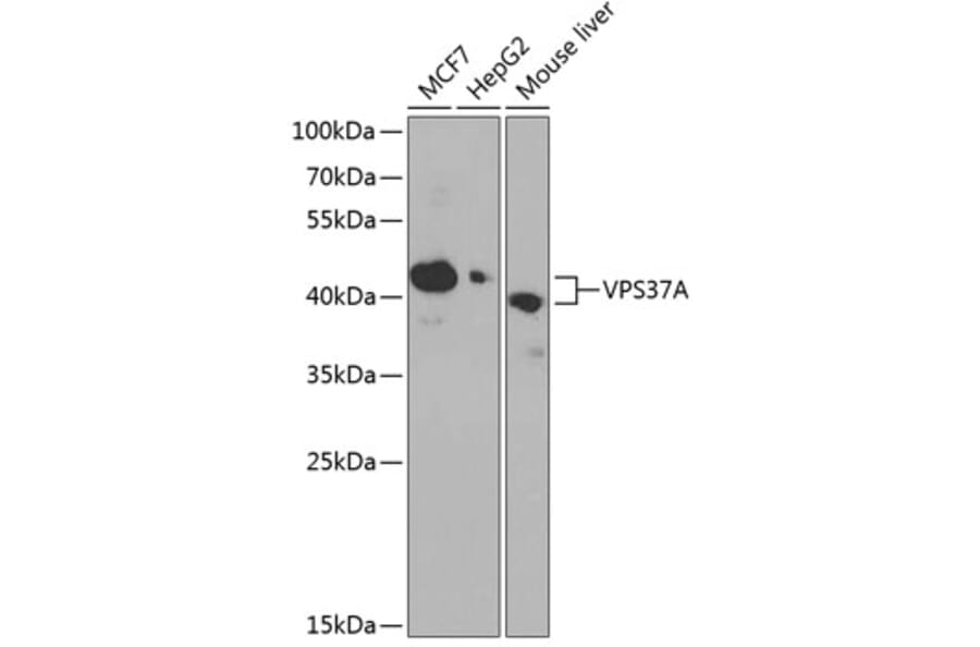Western Blot - Anti-VPS37A/HCRP1 Antibody (A89836) - Antibodies.com