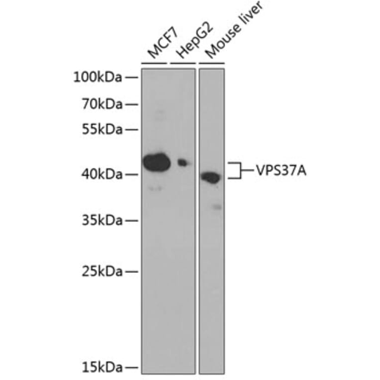 Western Blot - Anti-VPS37A/HCRP1 Antibody (A89836) - Antibodies.com