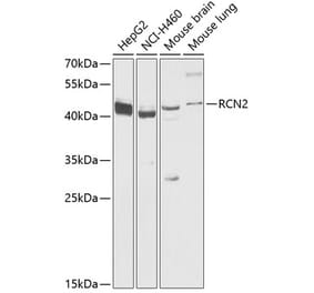 Western Blot - Anti-RCN2 Antibody (A89837) - Antibodies.com