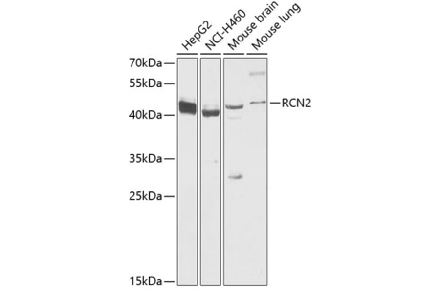 Western Blot - Anti-RCN2 Antibody (A89837) - Antibodies.com