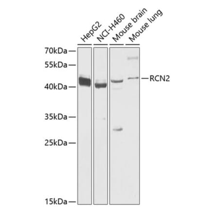 Western Blot - Anti-RCN2 Antibody (A89837) - Antibodies.com