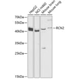 Western Blot - Anti-RCN2 Antibody (A89837) - Antibodies.com