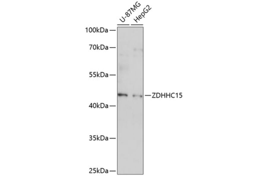 Western Blot - Anti-DHHC-15 Antibody (A89838) - Antibodies.com