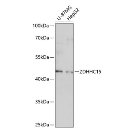 Western Blot - Anti-DHHC-15 Antibody (A89838) - Antibodies.com