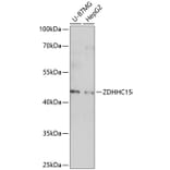 Western Blot - Anti-DHHC-15 Antibody (A89838) - Antibodies.com