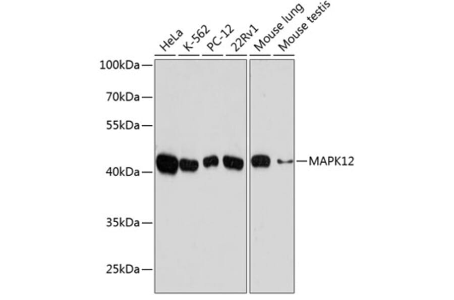 Western Blot - Anti-p38 gamma/MAPK12 Antibody (A89839) - Antibodies.com