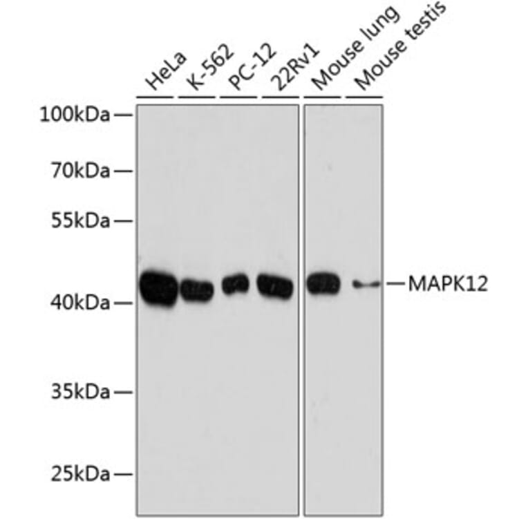 Western Blot - Anti-p38 gamma/MAPK12 Antibody (A89839) - Antibodies.com