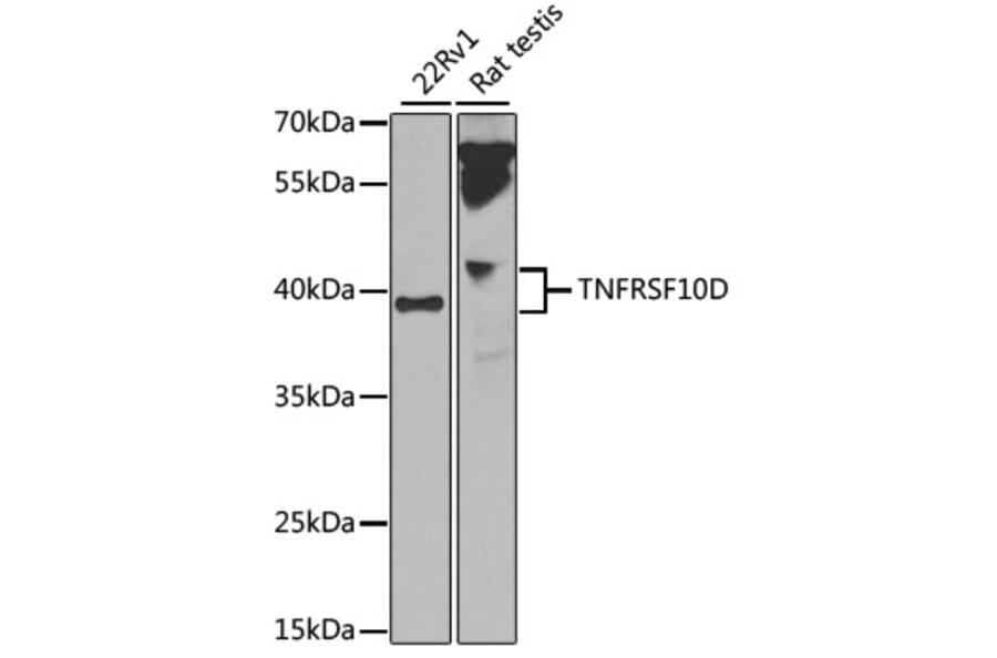 Western Blot - Anti-TNFRSF10D Antibody (A14078) - Antibodies.com