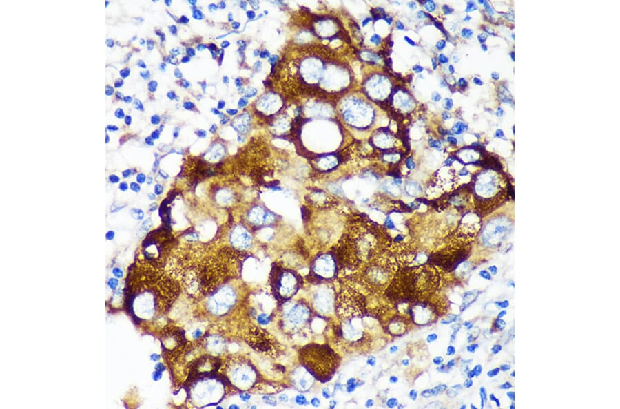 Immunohistochemistry - Anti-WIF1 Antibody (A89841) - Antibodies.com