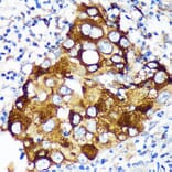Immunohistochemistry - Anti-WIF1 Antibody (A89841) - Antibodies.com