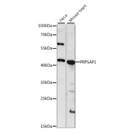 Western Blot - Anti-PRPSAP1 Antibody (A89842) - Antibodies.com