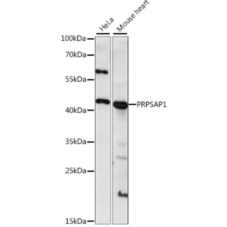 Western Blot - Anti-PRPSAP1 Antibody (A89842) - Antibodies.com