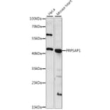 Western Blot - Anti-PRPSAP1 Antibody (A89842) - Antibodies.com