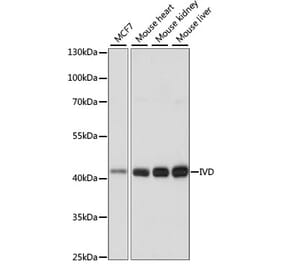 Western Blot - Anti-IVD Antibody (A89843) - Antibodies.com