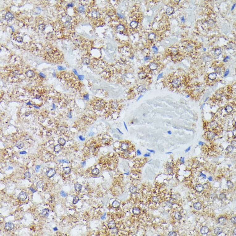 Immunohistochemistry - Anti-IVD Antibody (A89843) - Antibodies.com