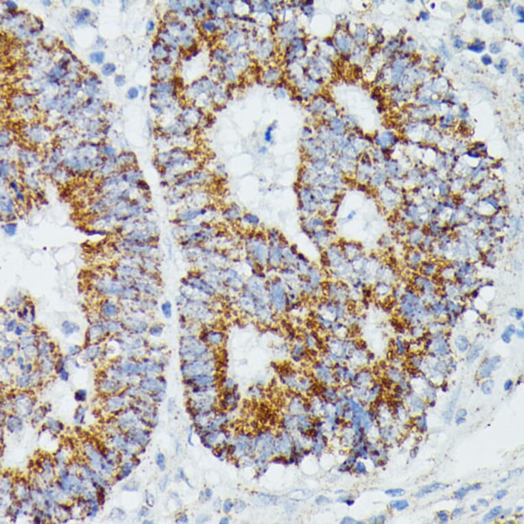 Immunohistochemistry - Anti-IVD Antibody (A89843) - Antibodies.com
