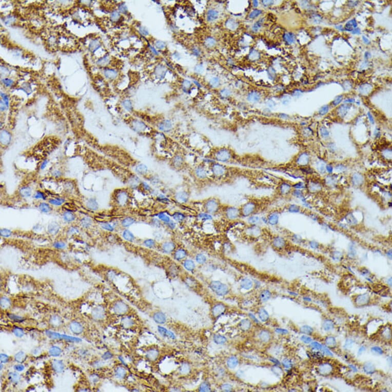 Immunohistochemistry - Anti-IVD Antibody (A89843) - Antibodies.com