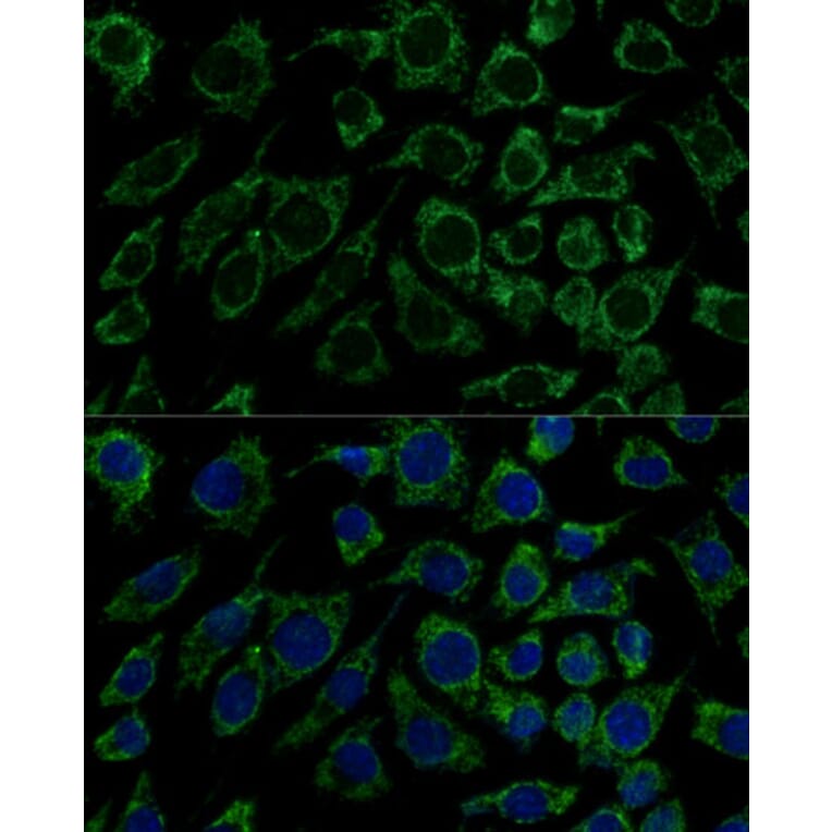 Immunofluorescence - Anti-IDH3B Antibody (A89844) - Antibodies.com