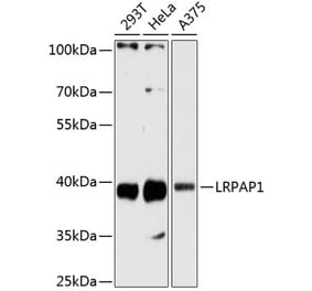 Western Blot - Anti-LRPAP1 Antibody (A89845) - Antibodies.com