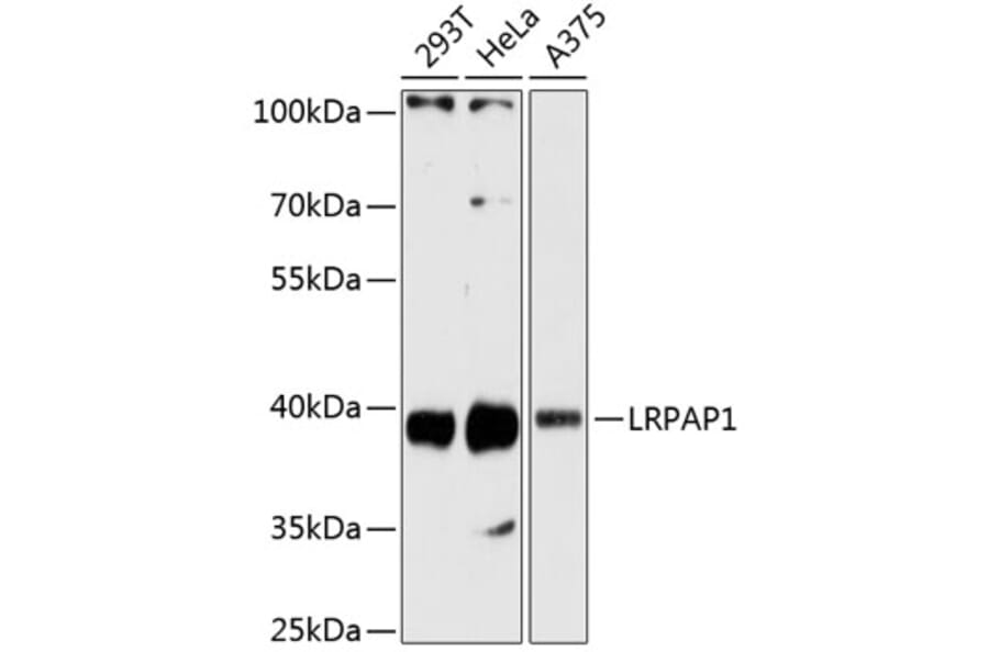 Western Blot - Anti-LRPAP1 Antibody (A89845) - Antibodies.com