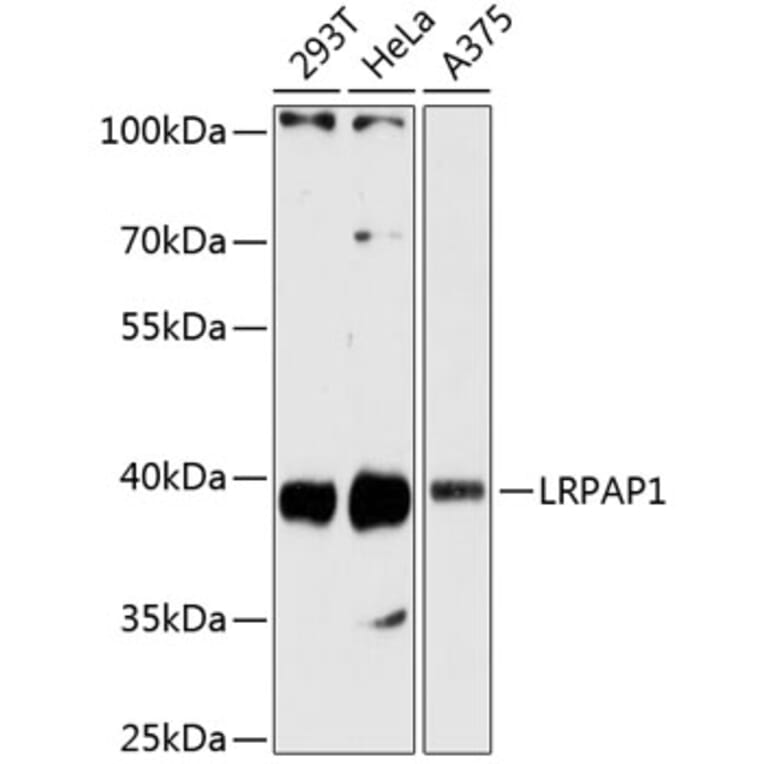 Western Blot - Anti-LRPAP1 Antibody (A89845) - Antibodies.com