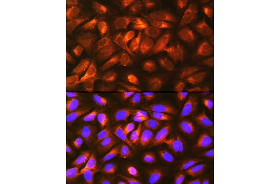 Immunofluorescence - Anti-LRPAP1 Antibody (A89845) - Antibodies.com