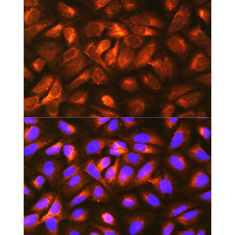 Immunofluorescence - Anti-LRPAP1 Antibody (A89845) - Antibodies.com